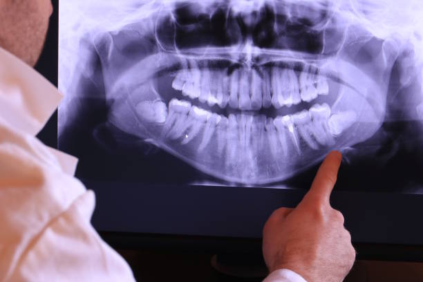 Best Tooth Infection Emergency Dentist  in North Merrick, NY